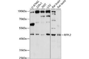 Western blot analysis of extracts of various cell lines, using RFPL2 antibody (ABIN7269923) at 1:3000 dilution. (RFPL2 抗体  (AA 50-150))