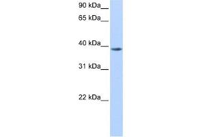 WB Suggested Anti-NUDT13 Antibody Titration:  0. (NUDT13 抗体  (N-Term))