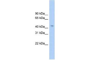 WB Suggested Anti-RG9MTD1 Antibody Titration:  0. (RG9MTD1 抗体  (Middle Region))