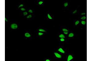 IHC-P analysis of Human HeLa cells, with FITC staining. (HIF1AN 抗体  (AA 2-349))