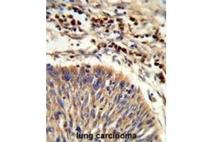 Immunohistochemistry (IHC) image for anti-Heat Shock 70kDa Protein 6 (HSP70B') (HSPA6) antibody (ABIN3003879) (HSPA6 抗体)