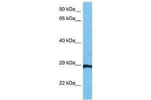Western Blotting (WB) image for anti-General Transcription Factor IIF, Polypeptide 2, 30kDa (GTF2F2) (Middle Region) antibody (ABIN2777297)