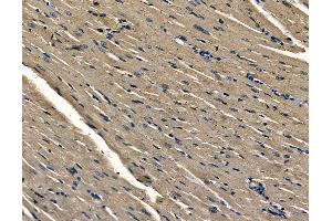 ABIN6263014 and ABIN6278668 at 1/100 staining rat heart tissue by IHC-P. (LSM1 抗体  (N-Term))