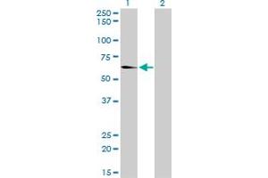 Western Blot analysis of EHD2 expression in transfected 293T cell line by EHD2 monoclonal antibody (M01), clone 2D8. (EHD2 抗体  (AA 365-427))