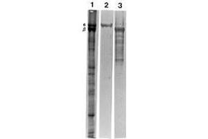 Western blotting polypeptides of ghosts of human erythrocytes (Lane 1, total protein profile) and reaction with MAb AF10 (Erythroid a-Spectrin)(Lane 2) and MAb DB2 (Erythroid b-Spectrin)