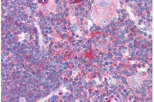 Human Thymus (formalin-fixed, paraffin-embedded) stained with HDAC6 antibody ABIN214772 at 5 ug/ml followed by biotinylated goat anti-rabbit IgG secondary antibody ABIN481713, alkaline phosphatase-streptavidin and chromogen. (HDAC6 抗体  (AA 69-118))