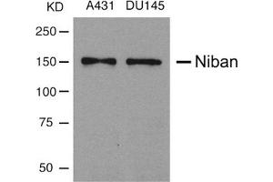 Western blot analysis of extracts from A431 and DU145 cells using Niban Antibody.