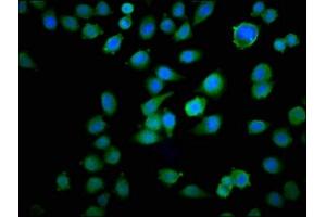 Immunofluorescence staining of Hela cells with ABIN7172906 at 1:100, counter-stained with DAPI. (TPT1 抗体  (AA 1-172))