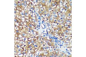 Immunohistochemistry of paraffin-embedded Rat liver using PYCR2 Rabbit pAb (ABIN7269766) at dilution of 1:100 (40x lens). (PYCR2 抗体  (AA 271-320))