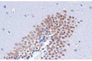 Immunohistochemistry of paraffin-embedded Mouse brain using DNMT3L Polyclonal Antibody at dilution of 1:100 (40x lens). (DNMT3L 抗体)