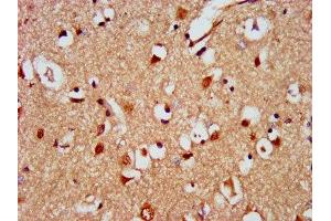 IHC image of ABIN7150918 diluted at 1:500 and staining in paraffin-embedded human brain tissue performed on a Leica BondTM system. (KIAA0319 抗体  (AA 153-268))