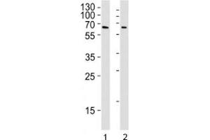 YY1 antibody western blot analysis in Daudi and U251 lysate. (YY1 抗体)