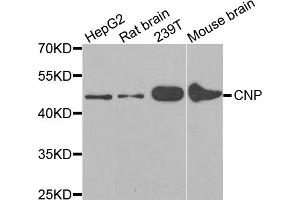Western blot analysis of extracts of various cell lines, using CNP antibody. (Cnpase 抗体)