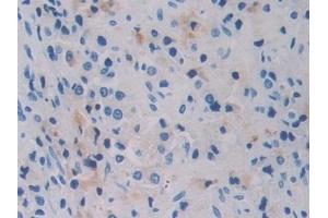 Immunohistochemistry (IHC) image for anti-Breast Cancer 1 (BRCA1) (AA 19-83) antibody (ABIN7433579)