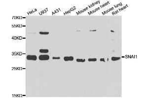 Western blot analysis of extracts of various cell lines, using SNAI1 antibody.