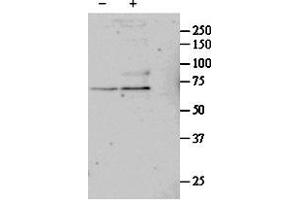 ABIN571032 (1µg/ml) staining of untreated (first lane) and TGF-bl-treated (second lane) primary cultured Human Lung fibroblast lysate. (SRF 抗体  (Internal Region))