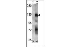 Western blot analysis of EphA6 (arrow) using rabbit polyclonal EphA6 Antibody. (EPH Receptor A6 抗体)