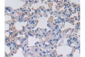 Detection of a1ACT in Mouse Lung Tissue using Polyclonal Antibody to Alpha-1-Antichymotrypsin (a1ACT) (a1-Antichymotrypsin (AA 23-253) 抗体)