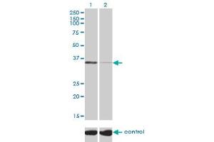Western blot analysis of TSTA3 over-expressed 293 cell line, cotransfected with TSTA3 Validated Chimera RNAi (Lane 2) or non-transfected control (Lane 1). (TSTA3 抗体  (AA 222-321))