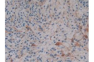 Immunohistochemistry (IHC) image for anti-Crystallin, alpha B (CRYAB) (AA 1-175) antibody (ABIN7435256)