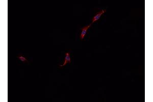 ABIN6268931 staining A549 cells by IF/ICC. (SQSTM1 抗体  (C-Term))
