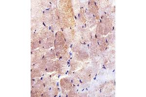 Immunohistochemical analysis of paraffin-embedded H. (Hexokinase 2 抗体  (AA 453-483))