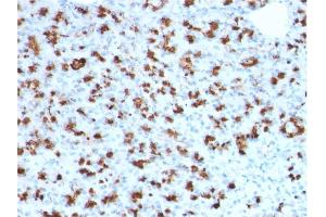 Formalin-fixed, paraffin-embedded human Pancreas stained with BARX1 Mouse Monoclonal Antibody (BARX1/2760). (BARX1 抗体)