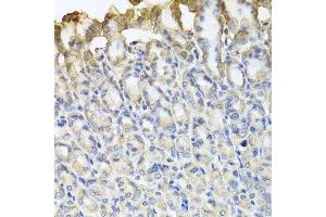 Immunohistochemistry (Paraffin-embedded Sections) (IHC (p)) image for anti-Tubulin, beta 8 (TUBB8) antibody (ABIN6149691)