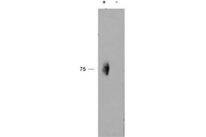 Western blot testing of immunoprecipitate from a lysate of human natural killer cells with (+) or without (-) pervanadate treatment of the cells using phospho-CD244 antibody at 2ug/ml. (2B4 抗体)