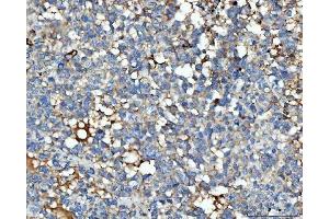 IHC analysis of THBS3 using anti-THBS3 antibody (ABIN7600759). (THBS3 抗体  (AA 23-486))