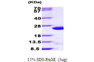 SDS-PAGE (SDS) image for ADP-Ribosylation Factor 4 (ARF4) (AA 1-180) protein (His tag) (ABIN666652) (ARF4 Protein (AA 1-180) (His tag))
