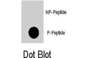 Dot blot analysis of PDPK1 (phospho S396) polyclonal antibody  on nitrocellulose membrane. (PDPK1 抗体  (pSer396))
