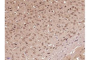 Paraformaldehyde-fixed, paraffin embedded Mouse brain Antigen retrieval by boiling in sodium citrate buffer (pH6.