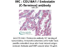 Image no. 1 for anti-Collagen, Type XVIII, alpha 1 (COL18A1) antibody (ABIN1733192) (COL18A1 抗体)