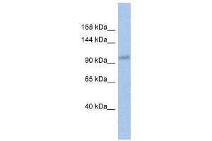 WB Suggested Anti-DDX24  Antibody Titration: 0. (DDX24 抗体  (Middle Region))