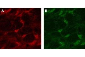 Expression of p75NTR in rat brainImmunohistochemical staining of rat brain with Anti-p75 NGF Receptor (extracellular) Antibody (ABIN7043344, ABIN7044755 and ABIN7044756). (Nerve Growth Factor Receptor (NGFR) Peptide)