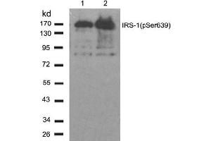 Image no. 2 for anti-Insulin Receptor Substrate 1 (IRS1) (pSer639) antibody (ABIN196980) (IRS1 抗体  (pSer639))