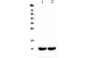 Western blot analysis of Uteroglobin using anti-Uteroglobin antibody . (SCGB1A1 抗体  (AA 22-96))