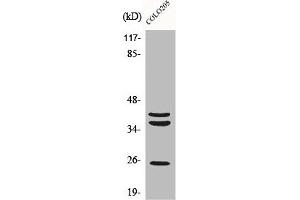 Western Blot analysis of COLO205 cells using Cathepsin B Polyclonal Antibody (Cathepsin B 抗体  (Internal Region))