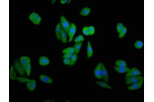 Immunofluorescence staining of HepG2 cells with ABIN7148935 at 1:133, counter-stained with DAPI. (GAK 抗体  (AA 939-1086))