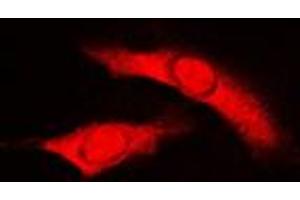 Immunofluorescent analysis of RAD23B staining in HuvEc cells. (RAD23B 抗体  (N-Term))