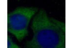 IF analysis of HepG2 cells, using ORM2 antibody (1/100 dilution) and AF488-conjugated Goat anti-Mouse IgG (H+L) antibody. (Orosomucoid 2 抗体)