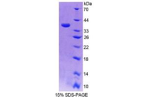 SDS-PAGE (SDS) image for Cytochrome P450, Family 17, Subfamily A, Polypeptide 1 (CYP17A1) (AA 201-507) protein (His tag) (ABIN6238939)