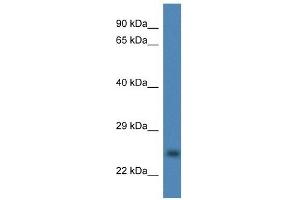 Western Blot showing CCS antibody used at a concentration of 1 ug/ml against Fetal Liver Lysate (Superoxide dismutase copper chaperone 抗体  (Middle Region))