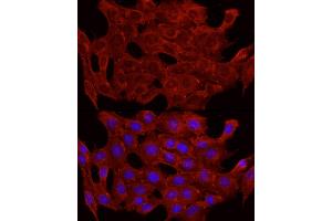 Immunofluorescence analysis of C2C12 cells using GLUT4 antibody (ABIN6134112, ABIN6147963, ABIN6147964 and ABIN6223551) at dilution of 1:100 (40x lens). (GLUT4 抗体  (C-Term))