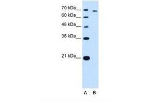 Image no. 2 for anti-threonyl-tRNA Synthetase (TARS) (AA 51-100) antibody (ABIN341310) (TARS 抗体  (AA 51-100))