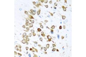 Immunohistochemistry of paraffin-embedded rat brain using EL antibody (ABIN6134651, ABIN6140118, ABIN6140119 and ABIN6221704) at dilution of 1:200 (40x lens). (HuC/ELAVL3 抗体  (AA 1-100))