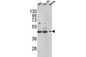 Western Blotting (WB) image for anti-Hydroxysteroid (17-Beta) Dehydrogenase 7 (HSD17B7) antibody (ABIN3002789)