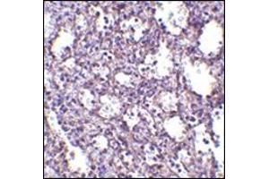 Immunohistochemistry of STIM2 in human spleen tissue with this product at 2. (Stim2 抗体  (Center))