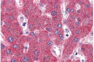 Human Liver (formalin-fixed, paraffin-embedded) stained with SERPINF2 antibody ABIN351490 at 3. (alpha 2 Antiplasmin 抗体  (AA 454-468))